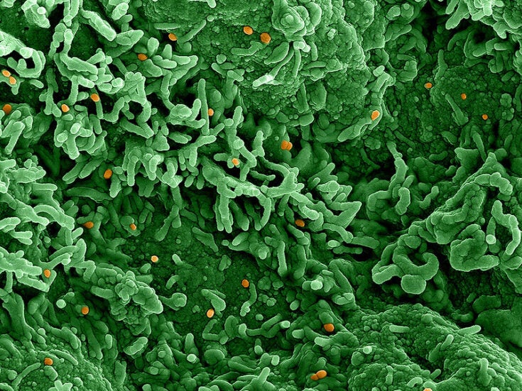 Roche and TIB Molbiol develop three monkeypox virus detection tests