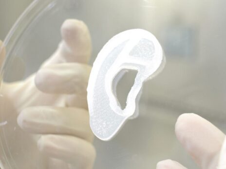 3DBio, Microtia-Congenital Ear Deformity Institute implant 3D-printed ear