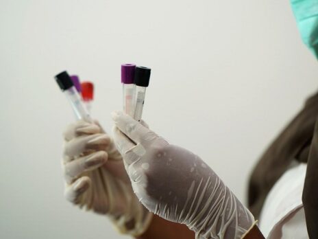 BioFluidica reports positive data from liquid biopsy platform trial