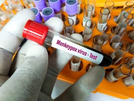 New monkeypox testing kits in development