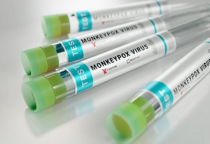Increased surveillance drives monkeypox virus in-vitro diagnostic test market