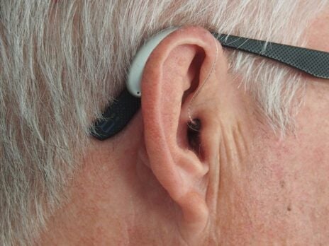 Envoy Medical gets FDA IDE approval to begin Acclaim cochlear implant trial