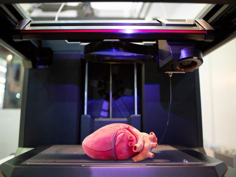 3D-printed organs and their affordability