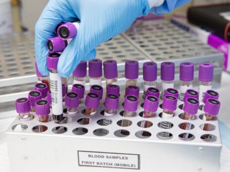 Vancouver Prostate Centre researchers develop blood test for cancer