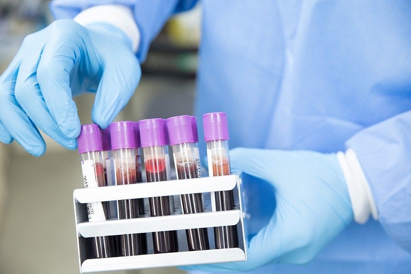 Universities of Edinburgh and Glasgow announce new leukaemia blood test