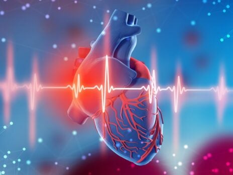 Cardiovascular monitoring: How early intervention saves lives