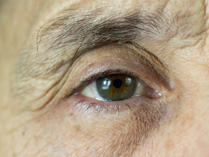 Pig skin protein helps corneal blindness patients