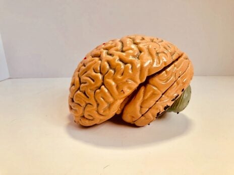 Brain Scientific obtains CE mark for neurological device