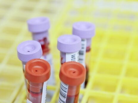 C₂N Diagnostics reports positive data for new Alzheimer’s blood test