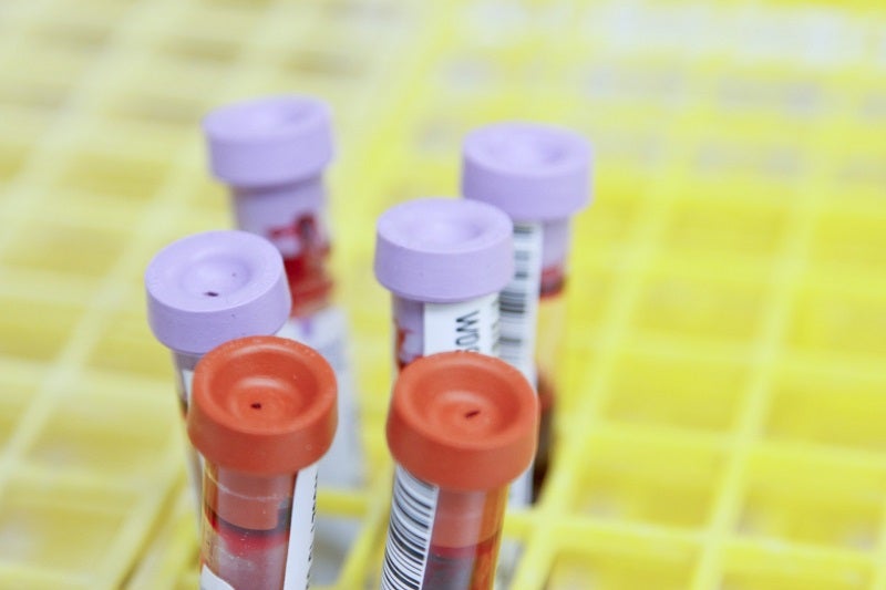 C₂N Diagnostics reports positive data for new Alzheimer’s blood test