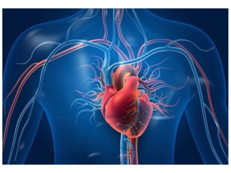Cardiovascular disease: Surgery trends and developments