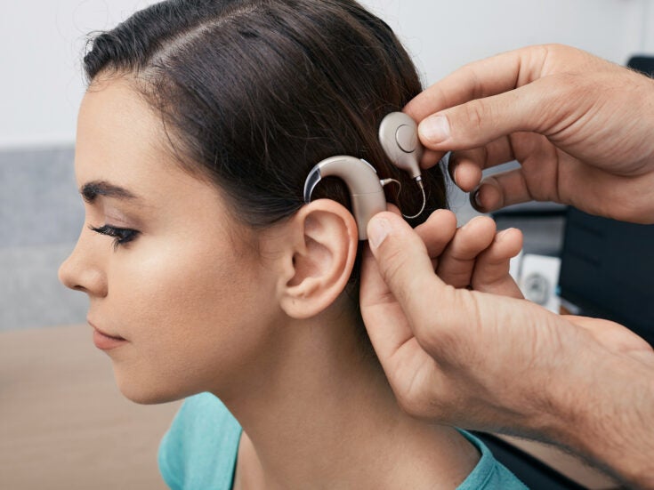 Cochlear implants: Meeting demand for reliable wire transmitters