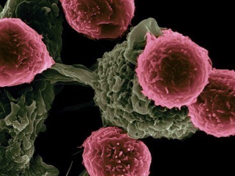 Chinese Academy of Sciences proposes new early cancer detection biosensor