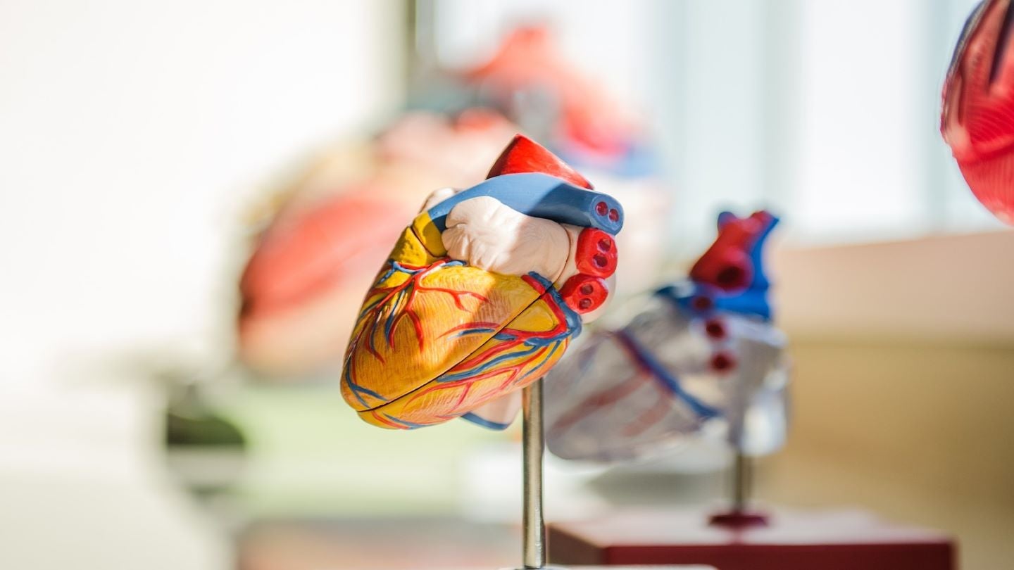 De FEops-studie toont aan dat HEARTguide de LAAC-procedure verbetert