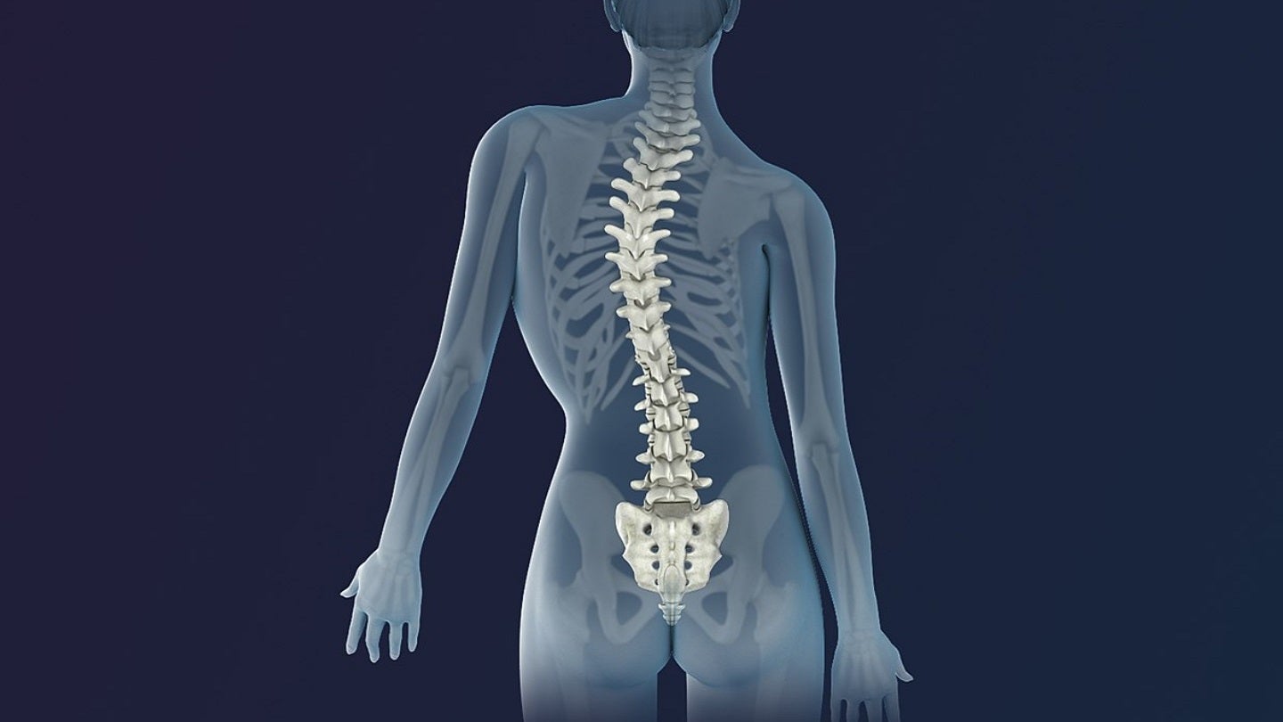 Scoliosis correction