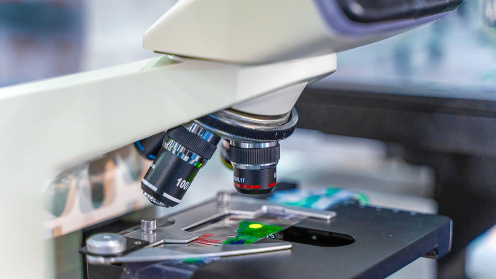 Leica Microsystems dodaje mikroskopię Viventis do swojego portfolio