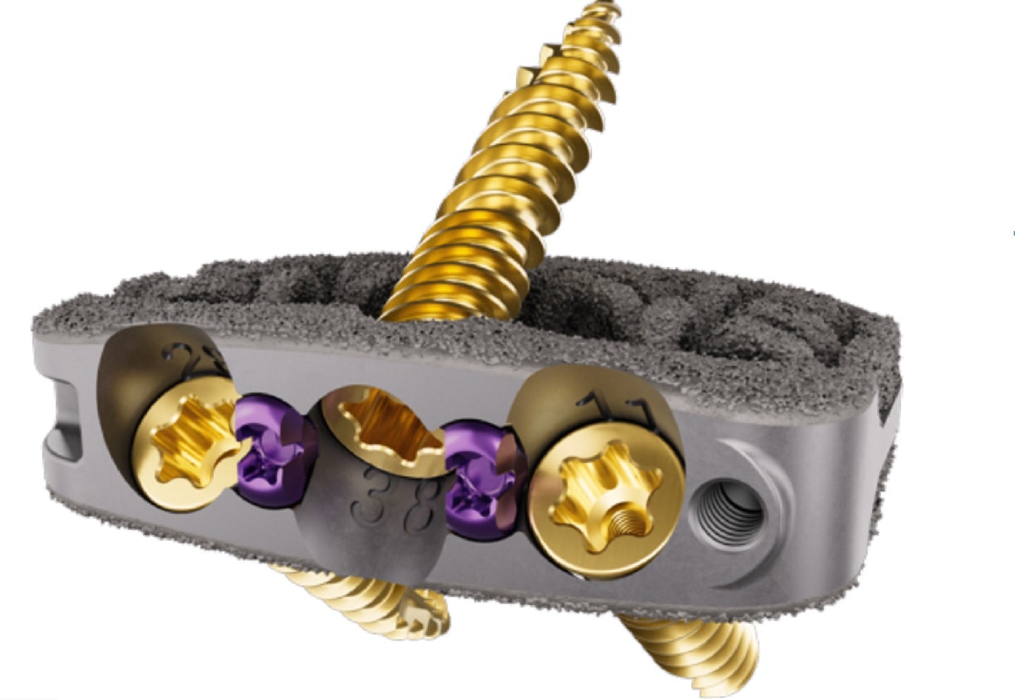 FDA grants 510(k) clearance of Camber Spine's SPIRA-A Integrated