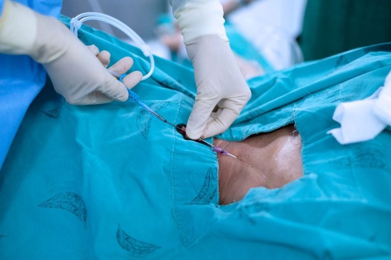 How guidewire technology is improving precision in critical medical procedures