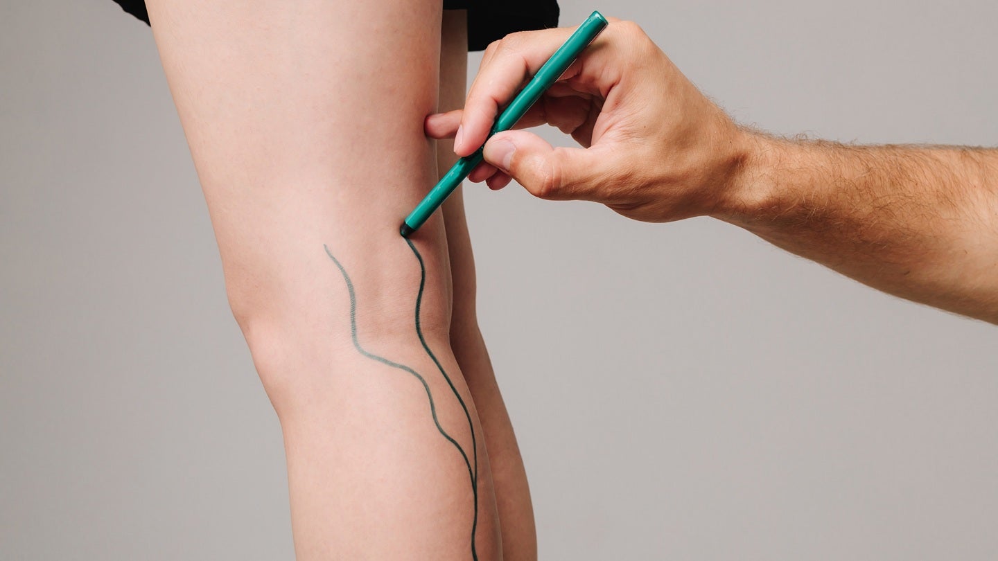 Okami secures m to advance clinical programmes for vascular disease