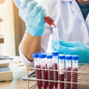 NAMSA acquires Labcorp