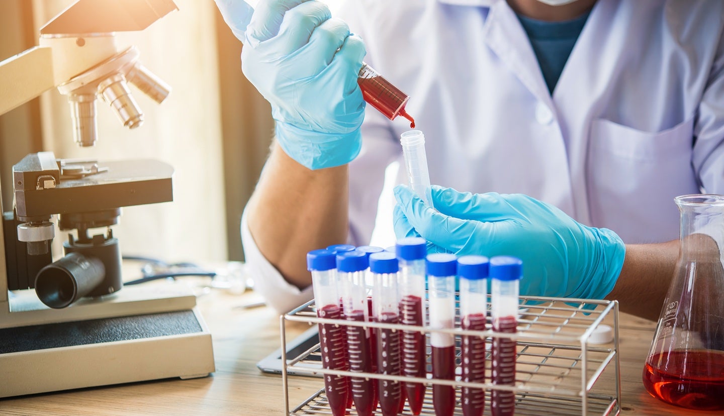 NAMSA acquires Labcorp’s medical device testing assets