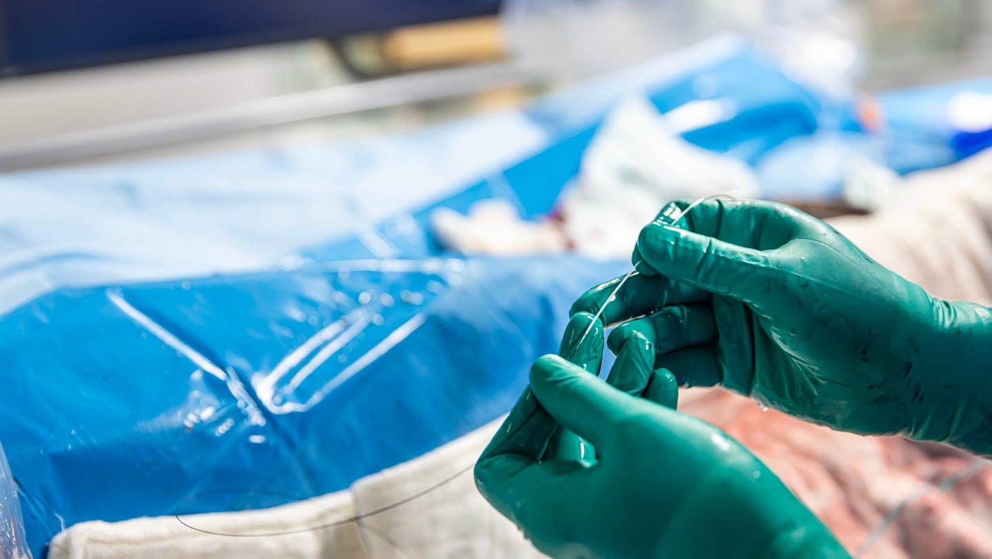 Zylox-Tonbridge to acquire German medical technology company Optimed