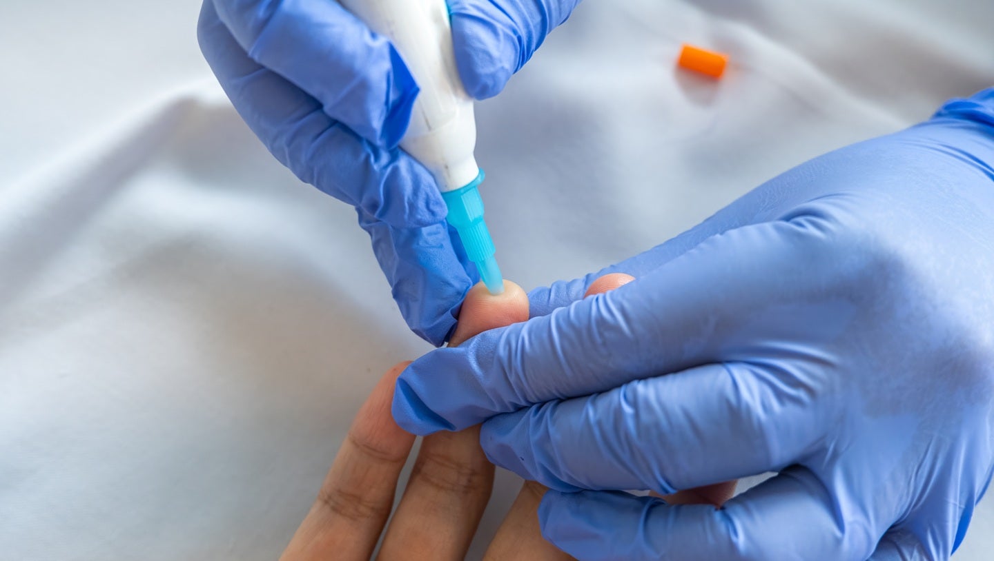 UK DRI announces trial of blood test for Alzheimer’s diagnosis