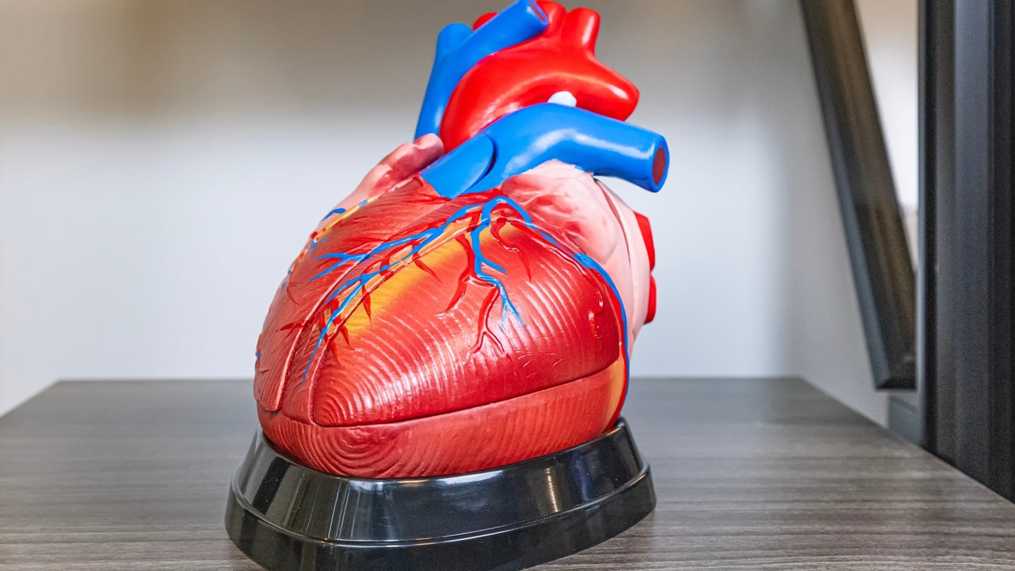 Abbott reports positive VERITAS study results for AFib