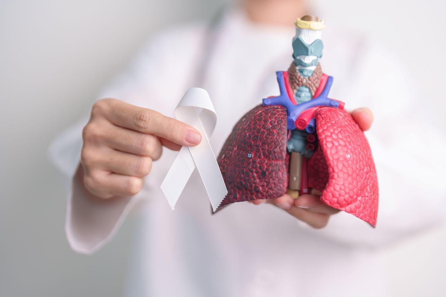 FDA clears Median Technologies’ lung nodule evaluation software