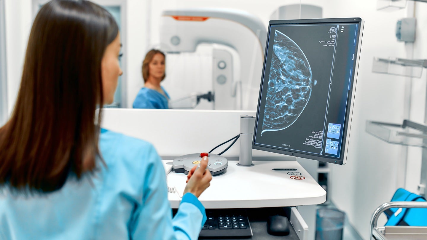 GE and DeepHealth expand partnership for breast screening solutions