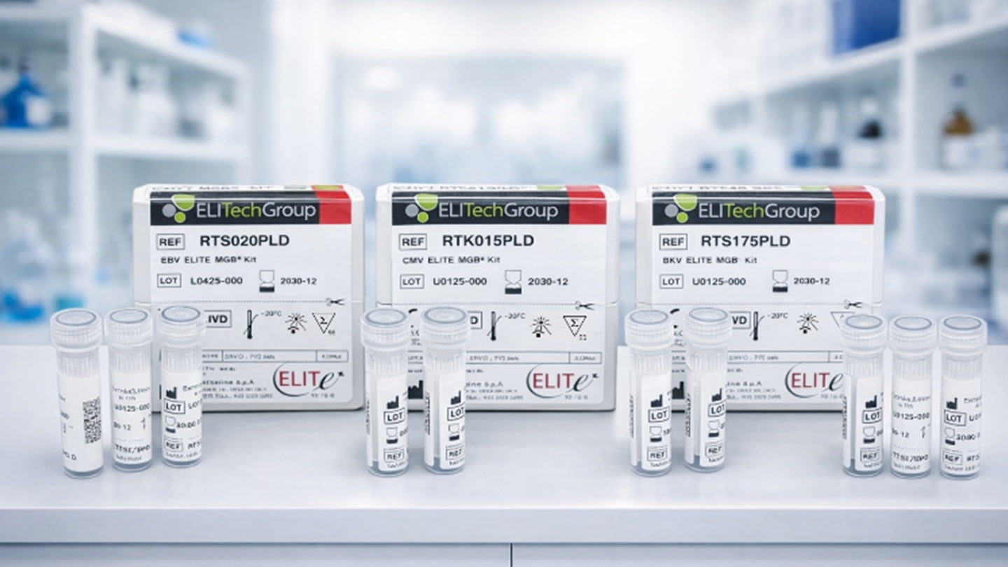 Bruker unveils MyGenius PRO diagnostics system