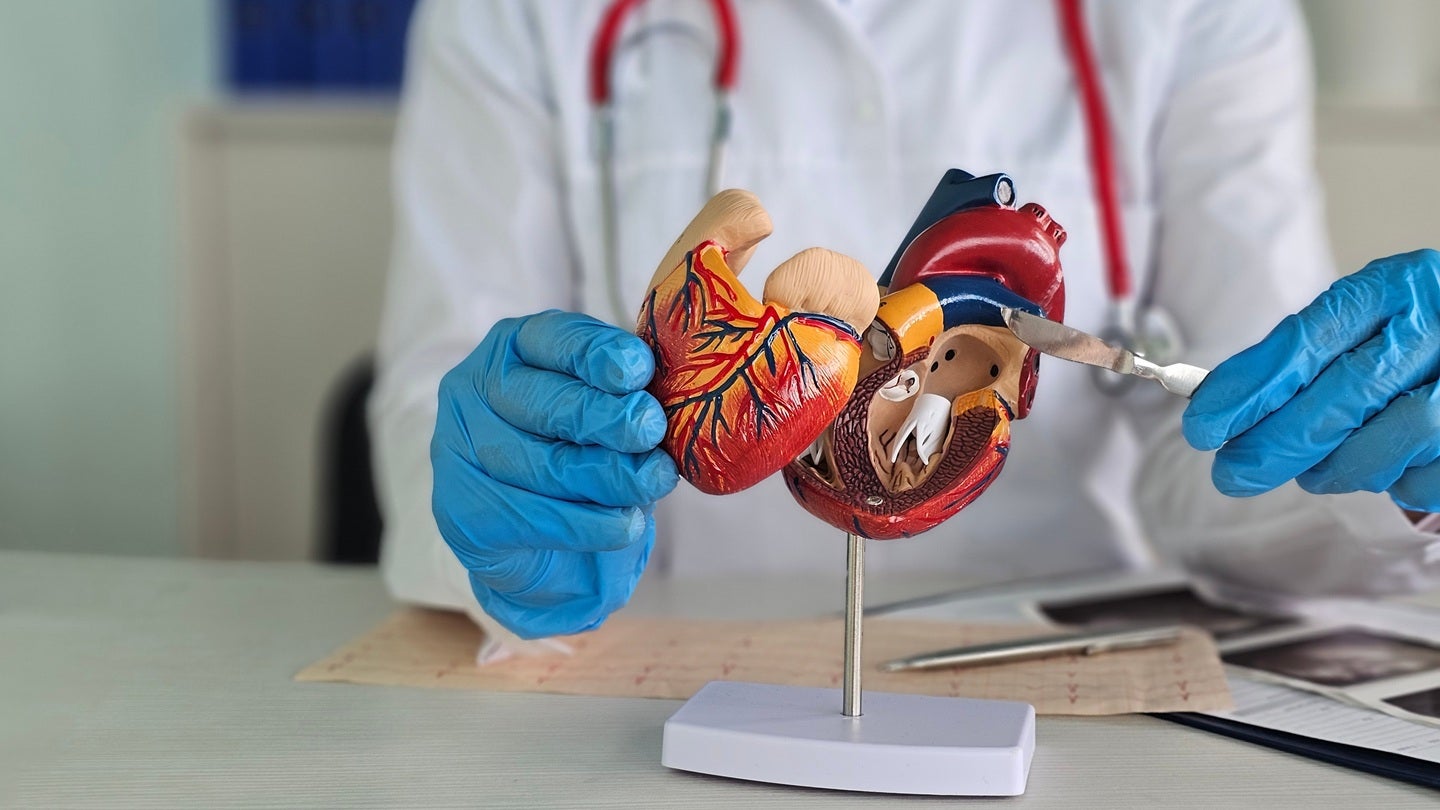 BrioHealth secures FDA approval to launch BrioVAD system trial