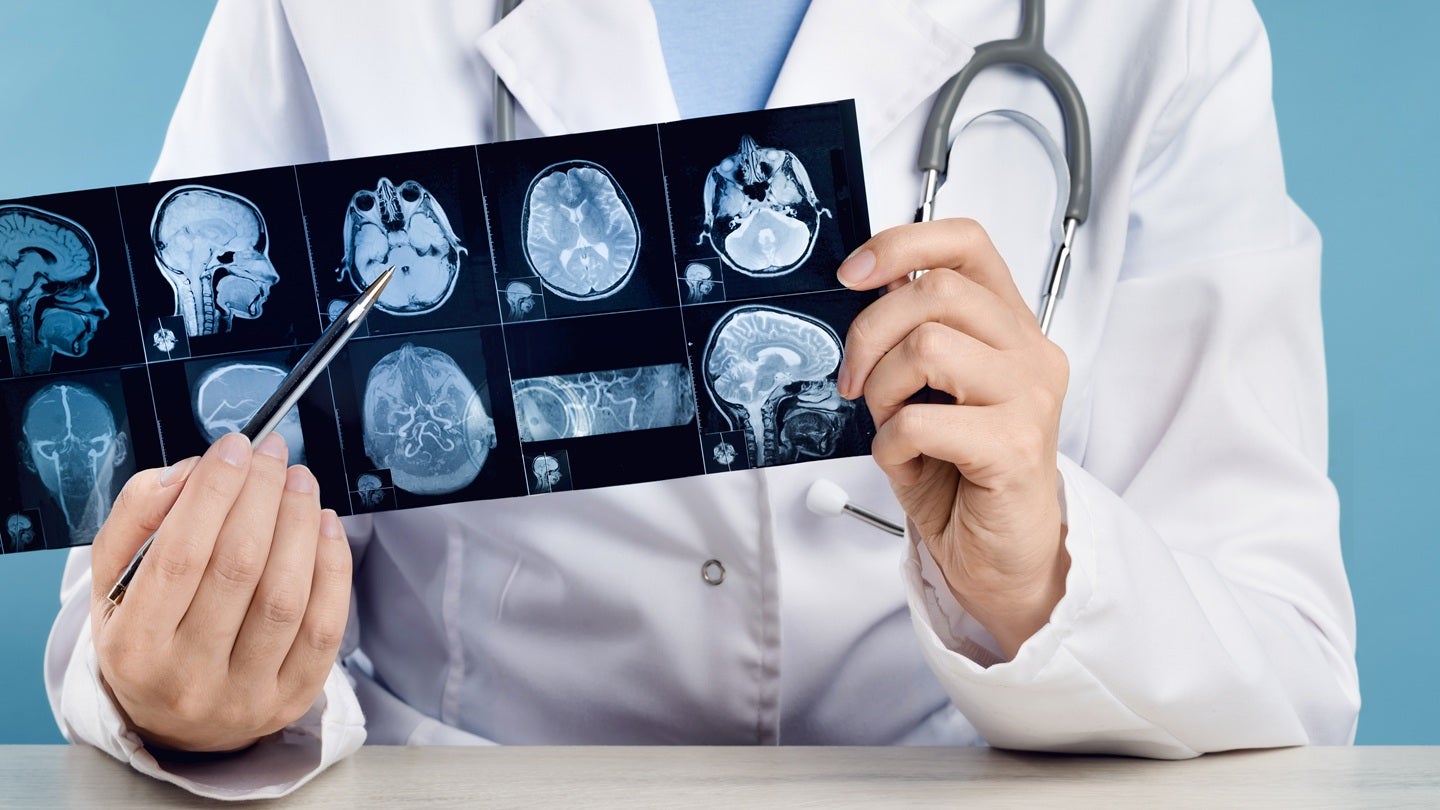 Nervonik closes $52.5m Series B funding to advance PNS system