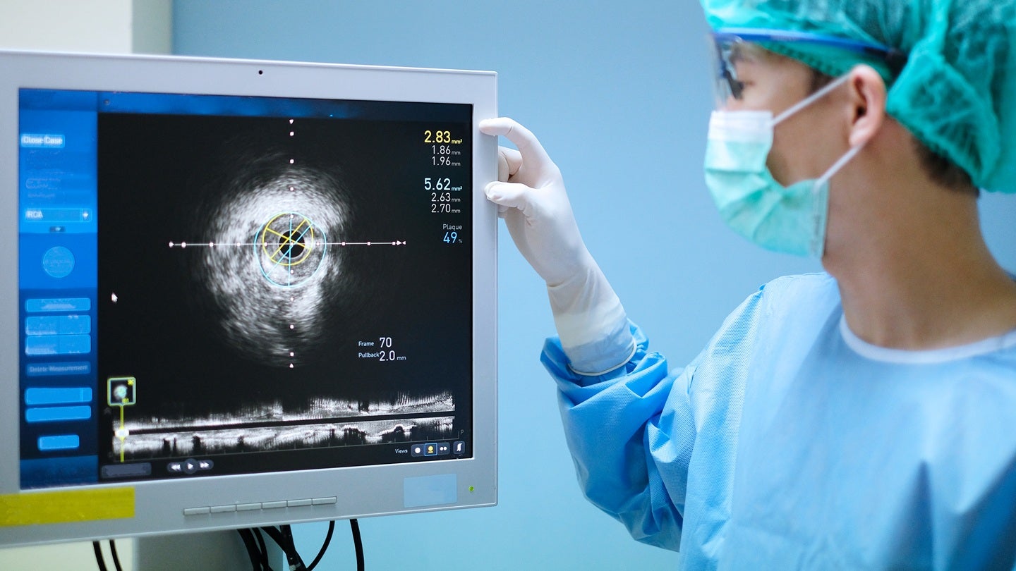 Abbott secures FDA approval for Ultreon 3.0 imaging platform