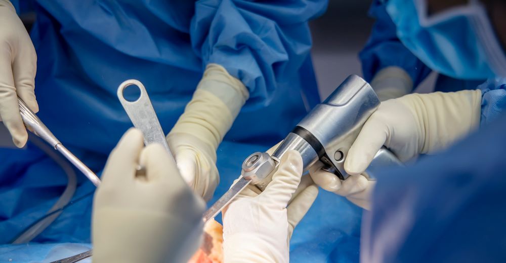High-quality steel: A prerequisite for safer surgical procedures