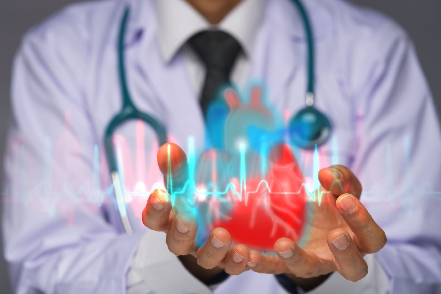 iRhythm demonstrates value in 14-day monitoring for arrhythmia recurrence