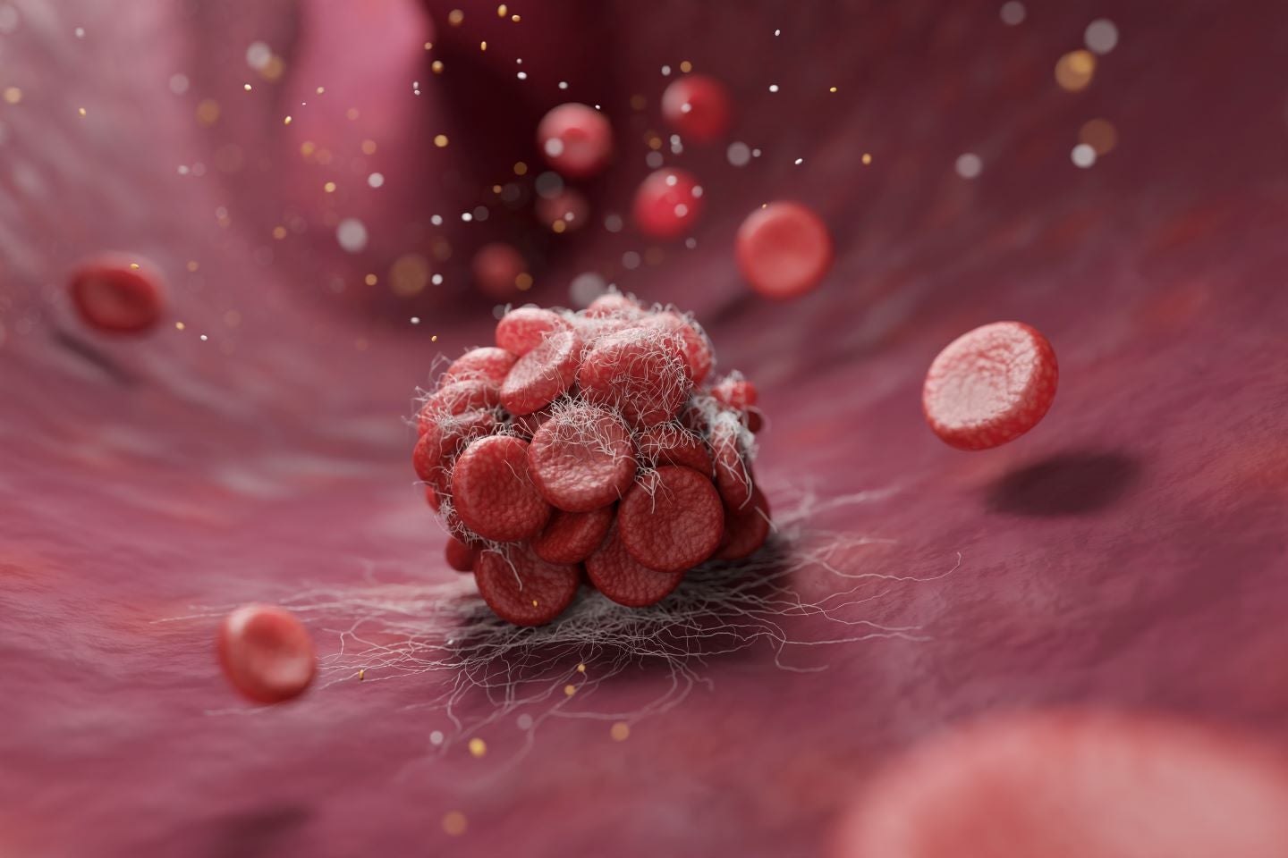 E2 raises $80m to advance VTE system’s commercialisation