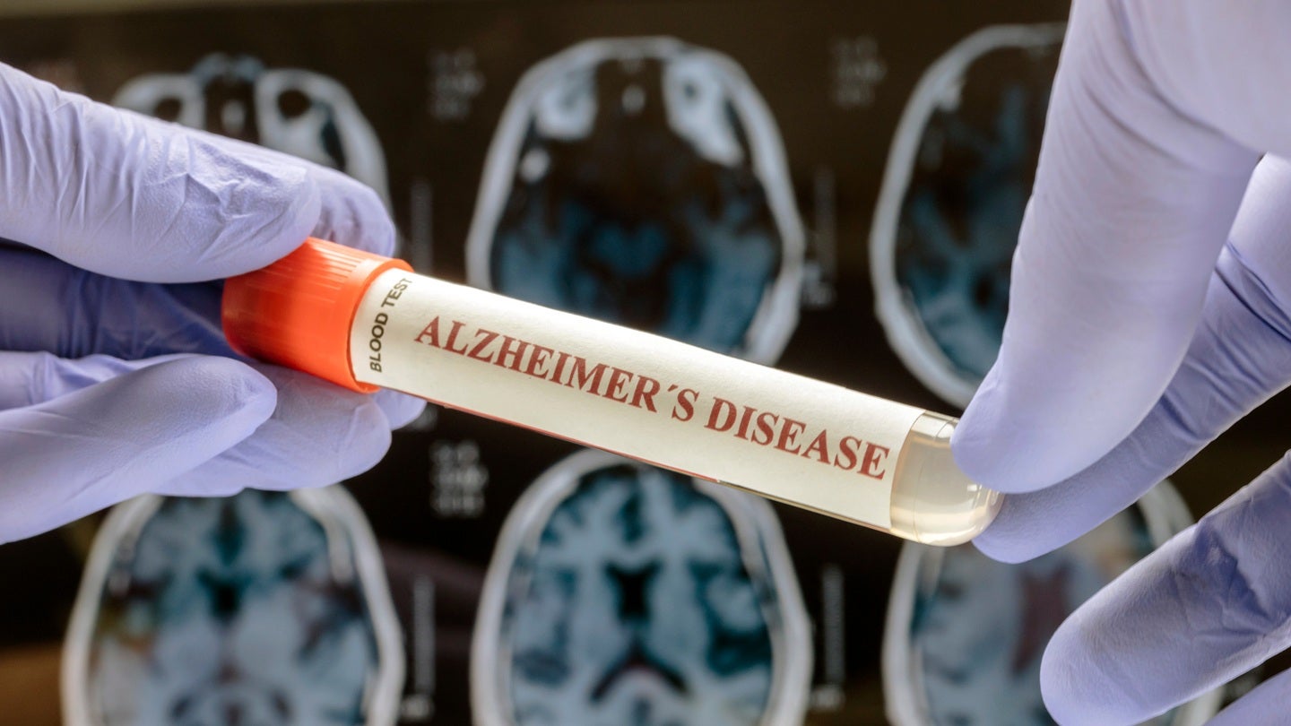 Roche’s Elecsys pTau217 blood test secures CE mark for Alzheimer’s