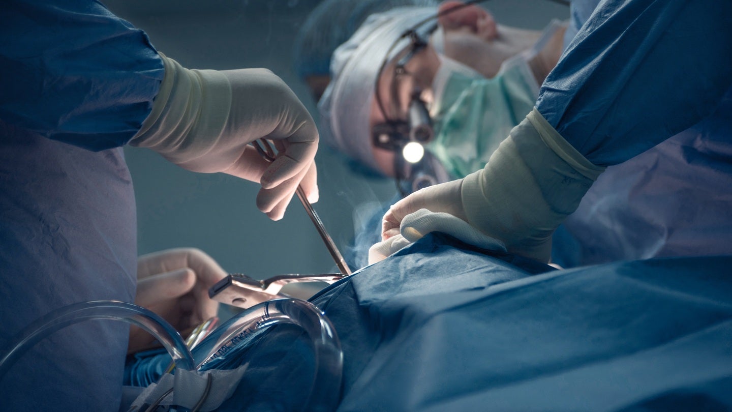 Endologix purchases thrombectomy system from Surmodics