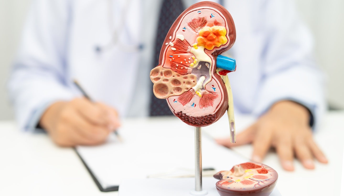 BD launches Elyra thulium fiber laser system for kidney stone care