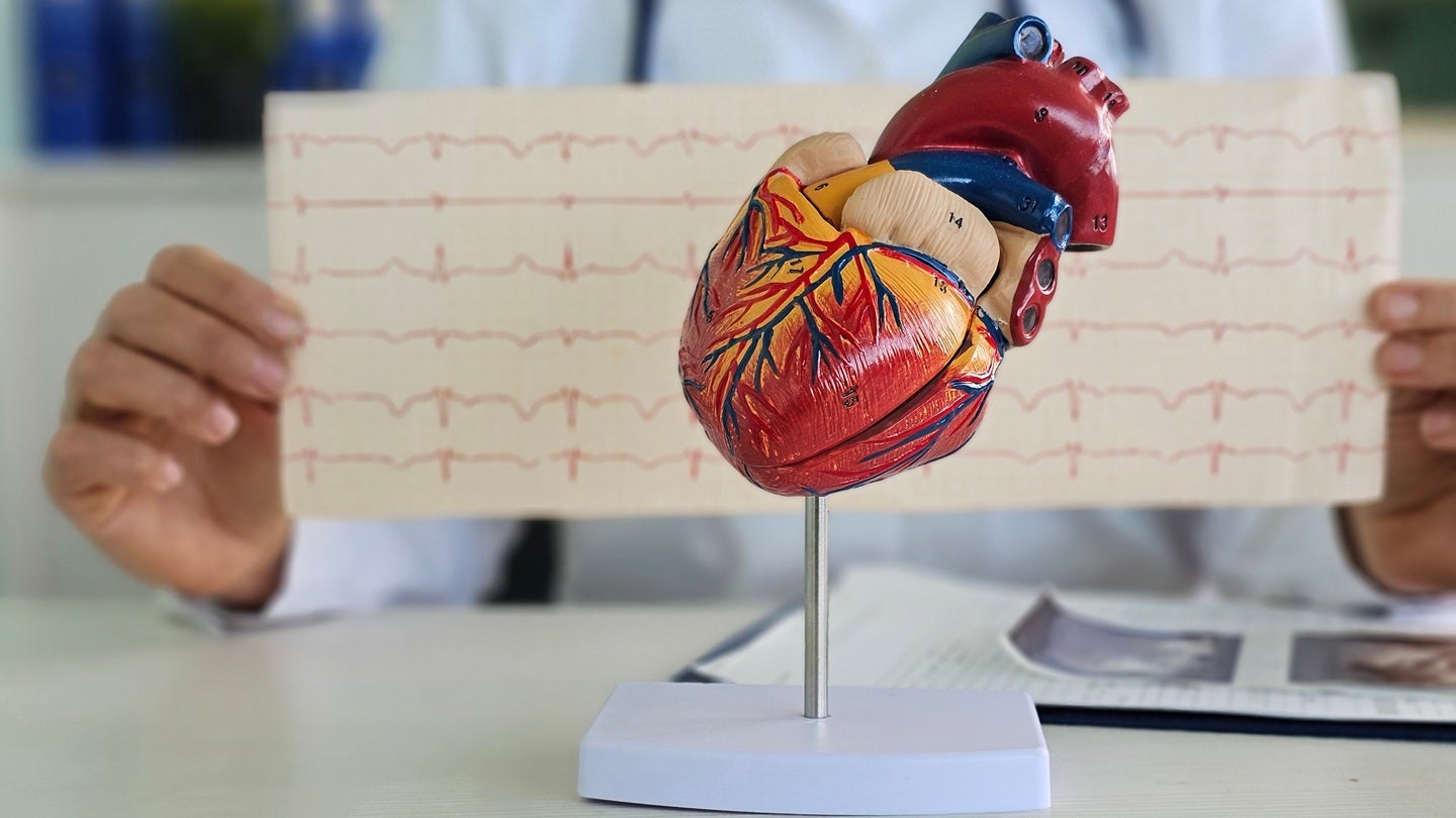 Adagio Medical seeks FDA PMA for ventricular ablation system