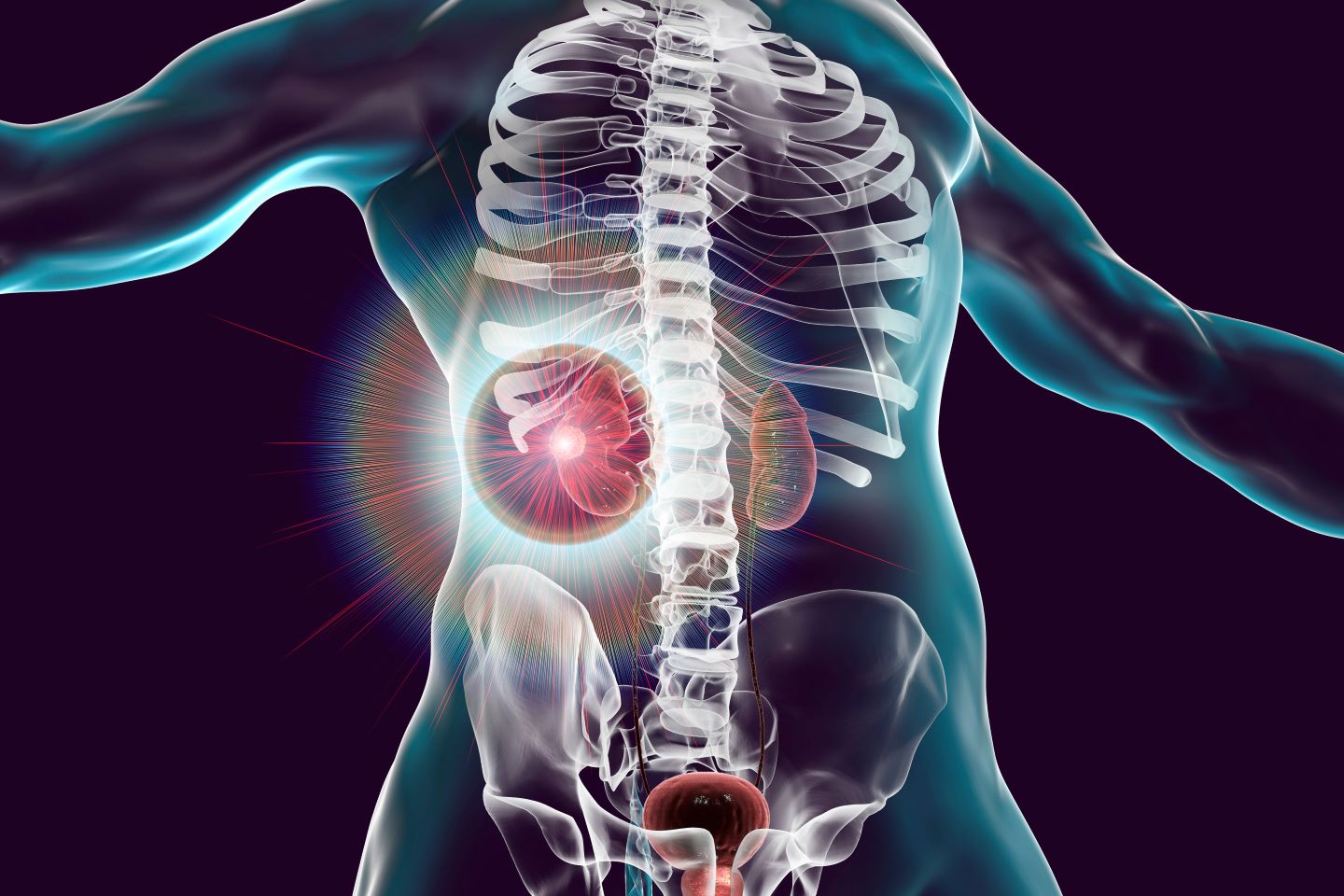 Podcast: The implications of NICE’s formal recommendation for cryoablation’s use in treating kidney tumours