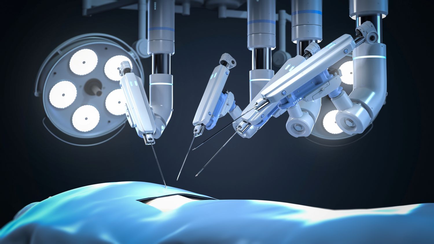 Enabling steerability at the microscale: the significance of nitinol