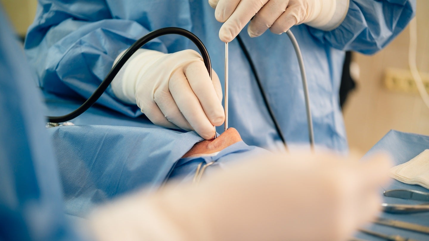 Medtronic secures CE mark for Stealth AXiS system for ENT surgery