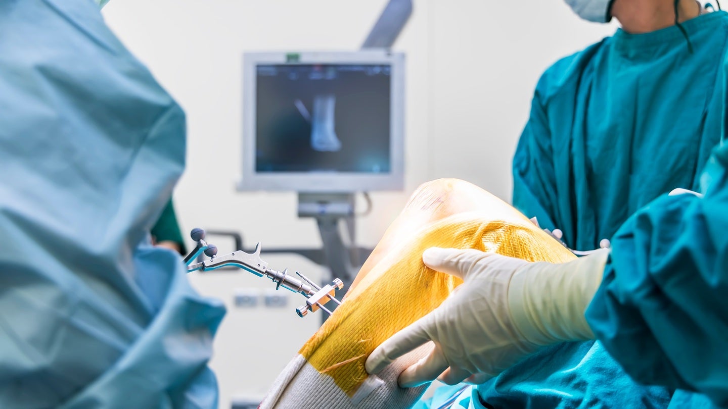 Made Scientific to manufacture NOVAKnee implant