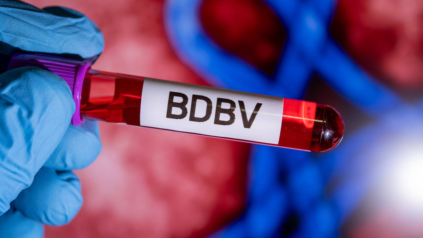 Roche develops RUO PCR assay to detect rare Ebola Bundibugyo virus