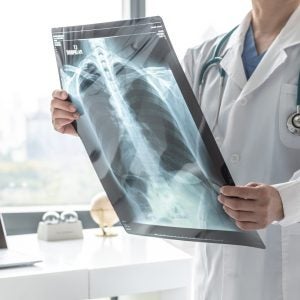 FDA Aidoc AI radiology