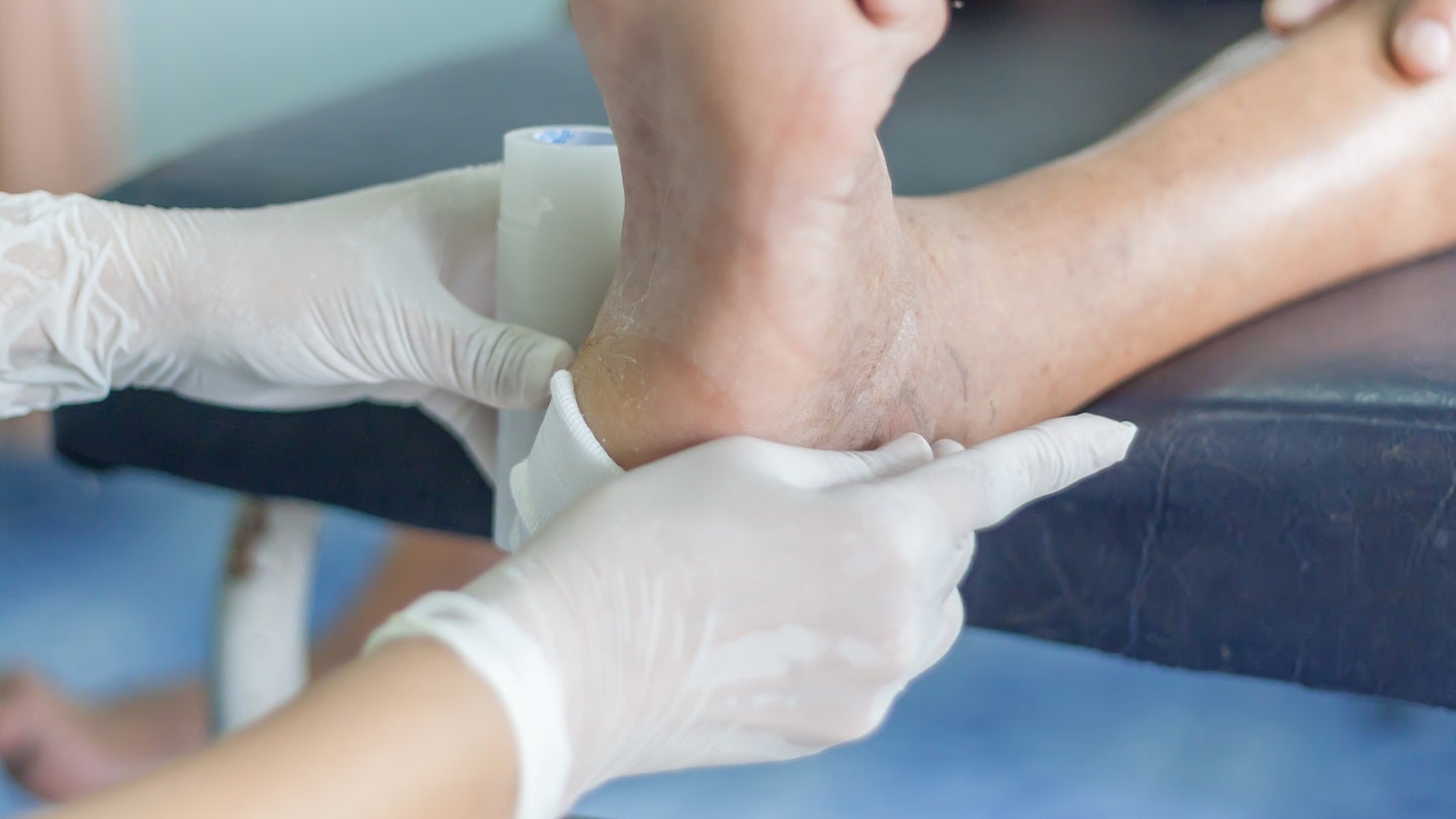 Hanyang University creates microneedle patch for diabetic wounds