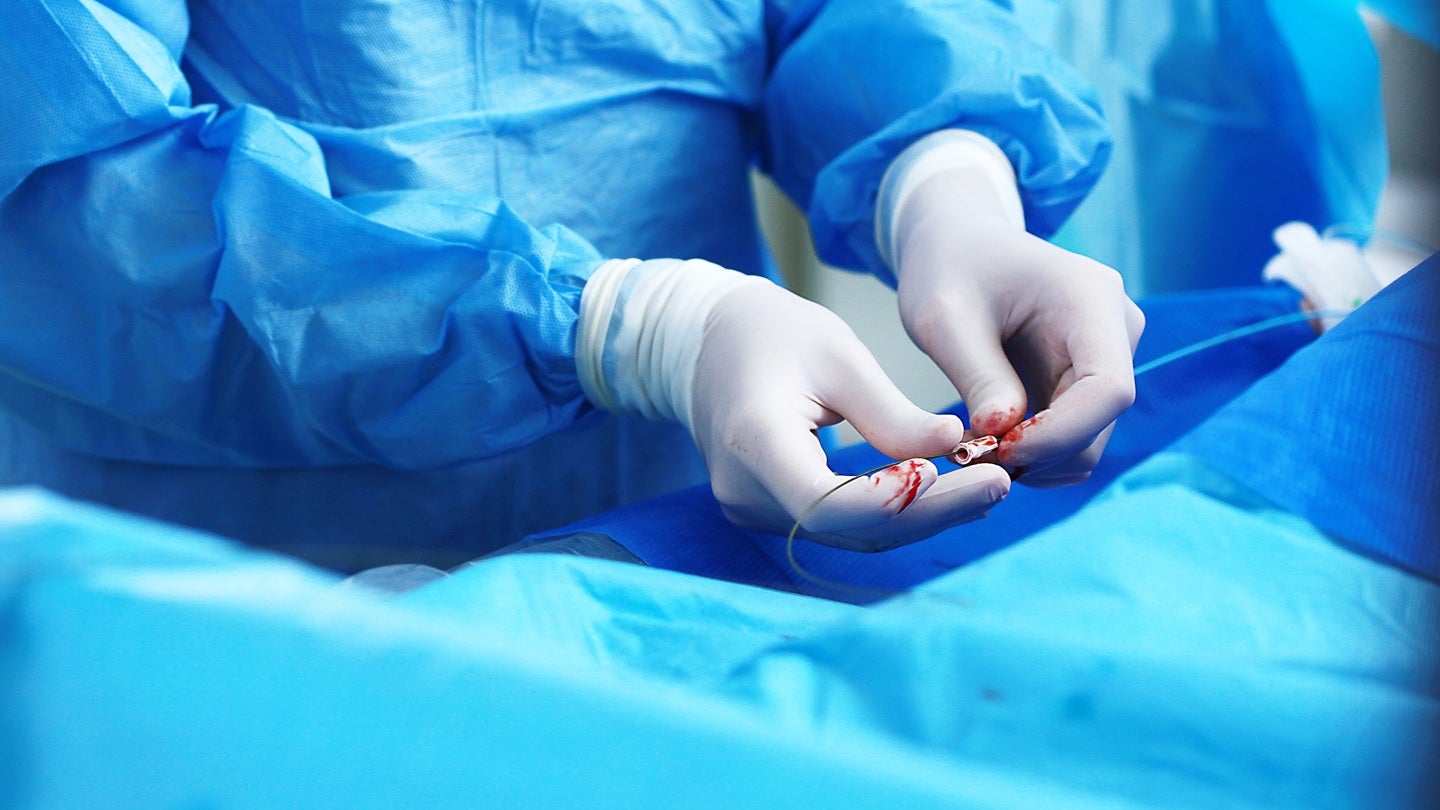 CereVasc concludes patient enrolment in STRIDE trial of eShunt