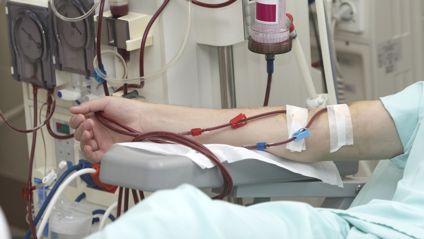 Over half of target patients enrolled in Xeltis’ aXess US pivotal trial